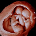 ultrasound-triples-nb